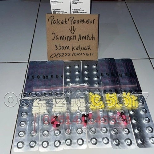 Paket Tuntas Obat Aborsi Cytotec Sebagai Obat Penggugur Ampuh